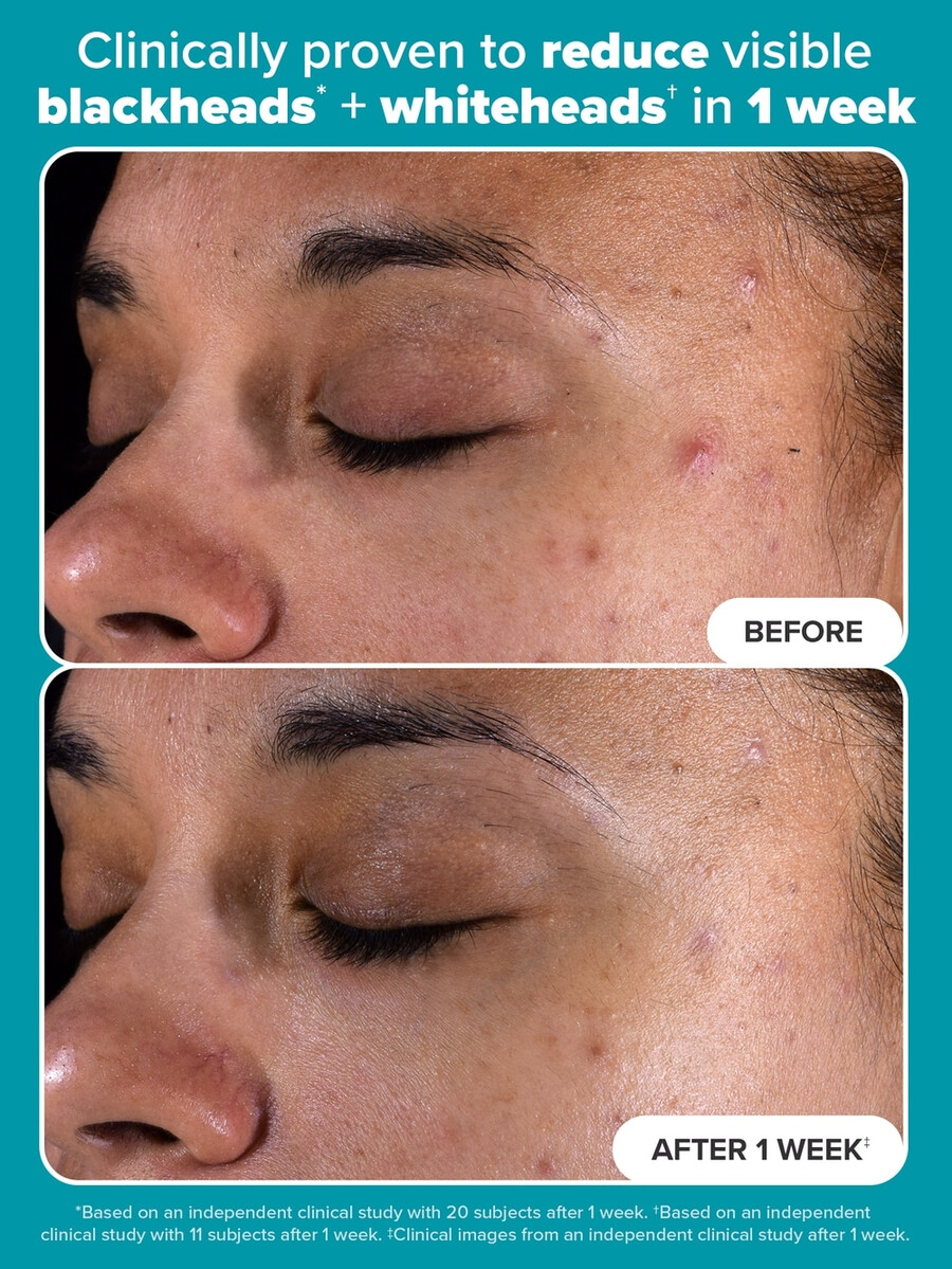 2 bha exfoliërende toner pads