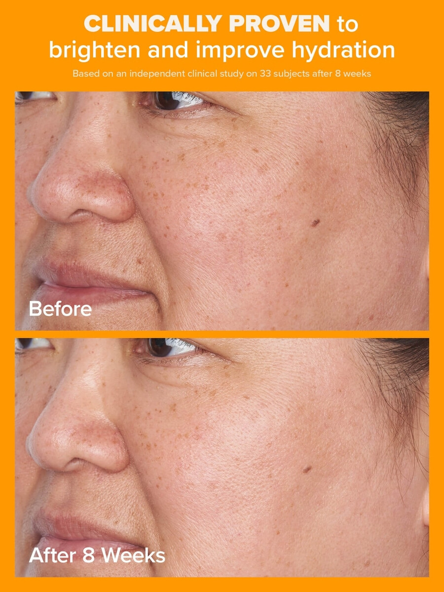 5 vitamine c lichte hydraterende crème met spf 50